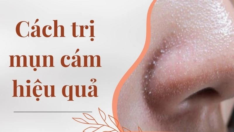 Bí quyết dọn sạch mụn cám nhờ quả chanh tươi