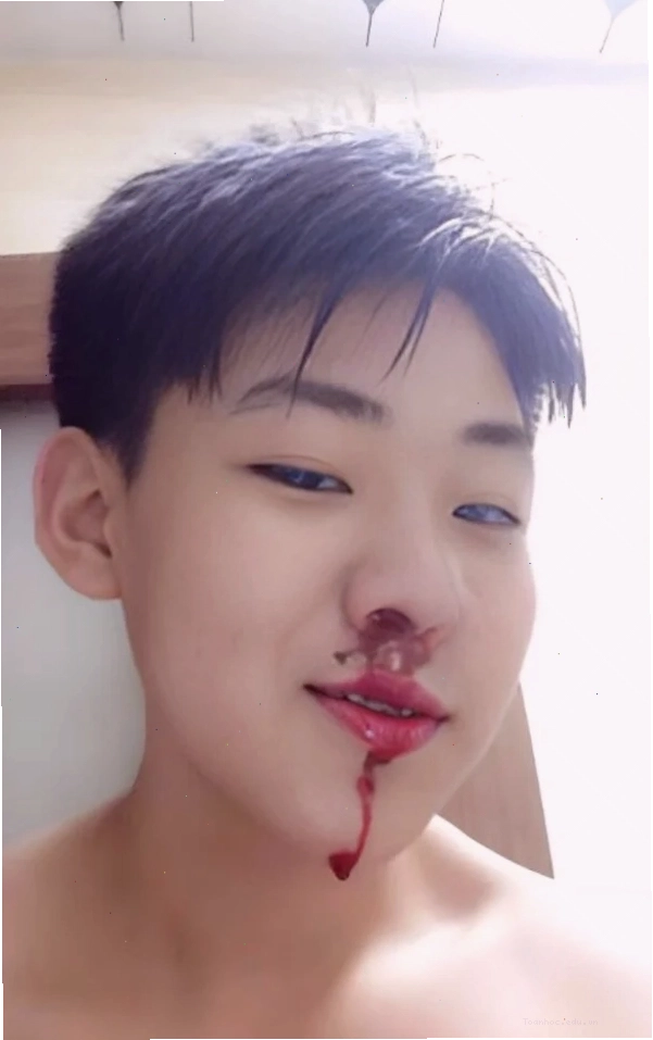 Ảnh meme chảy máu mũi tổng hợp nhiều biểu cảm khác nhau